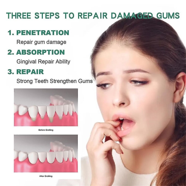 Gum Therapy Gel, Gum Rerowth För vikande tandkött, Gum Repair Återväxt