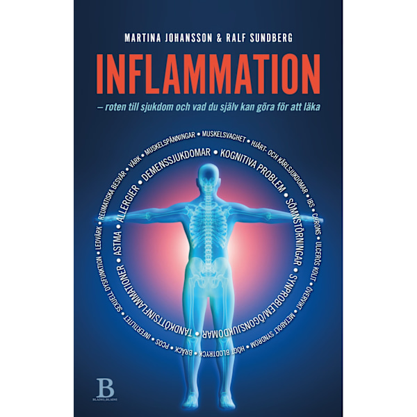 Inflammation 9789188429711