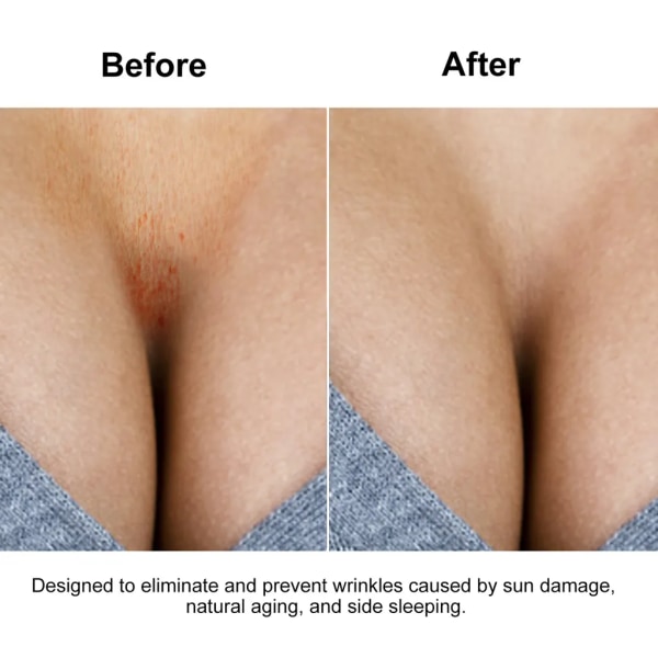 Återanvändbara silikonbröstskydd mot rynkor för att eliminera och förhindra bröstrynkor