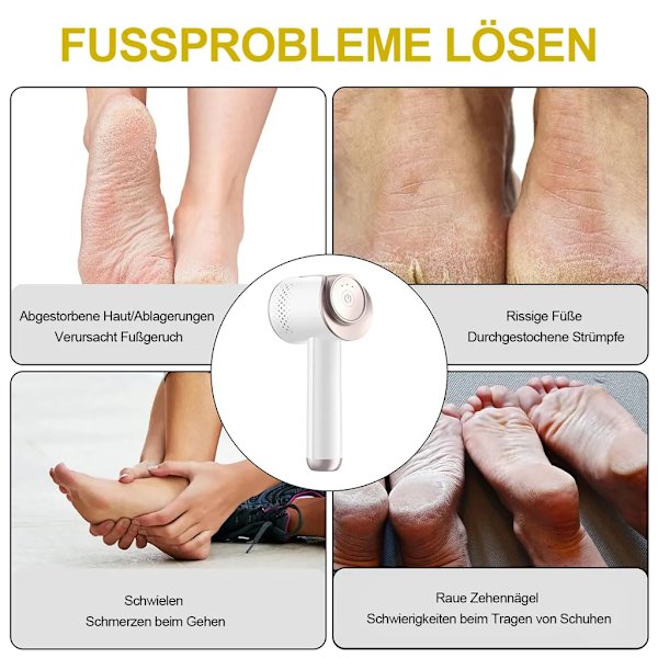 Elektrisk fotfil, med 3 hastigheter & 3 sliphuvuden, för död/hård, sprucken/torr hud
