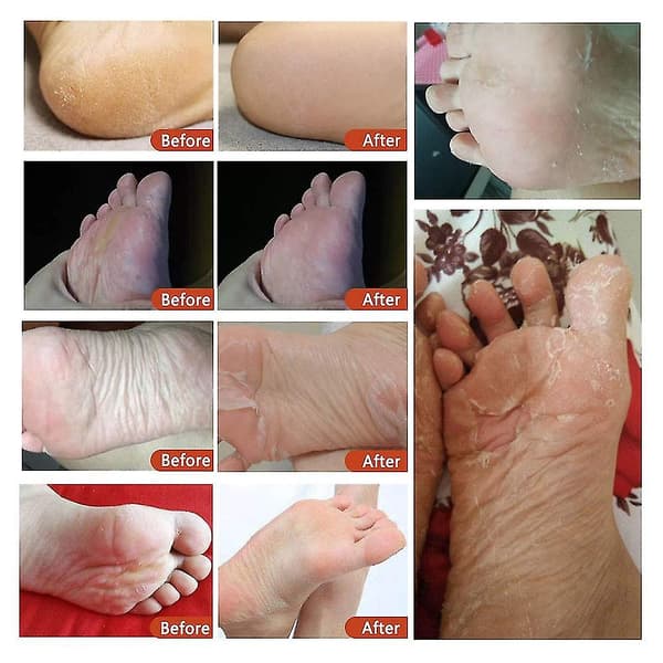 Fotmask Peeling 3-pack Kokosfotmask Peeling Döda Hudförhårdnader
