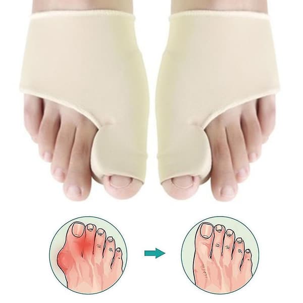Bunion Corrector Tårettetang med Gelputer, Ortopedisk Stortå