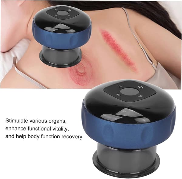 Vakuum Massage Koppesæt - Silikone Sugekopper til Effektiv Dybdevævs Massage Kit