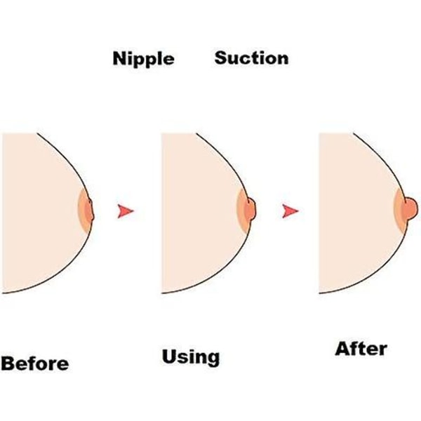 Bröstvårtkorrektor för inverterad bröstvårtavdragare eller förlängningslåsförstärkningshjälp med cover för kvinnliga mammor som ammar brun