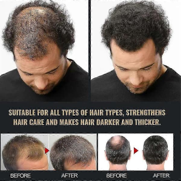 3 kpl Spartan Root Shampoo, Spartan Shampoo, shampoo Root