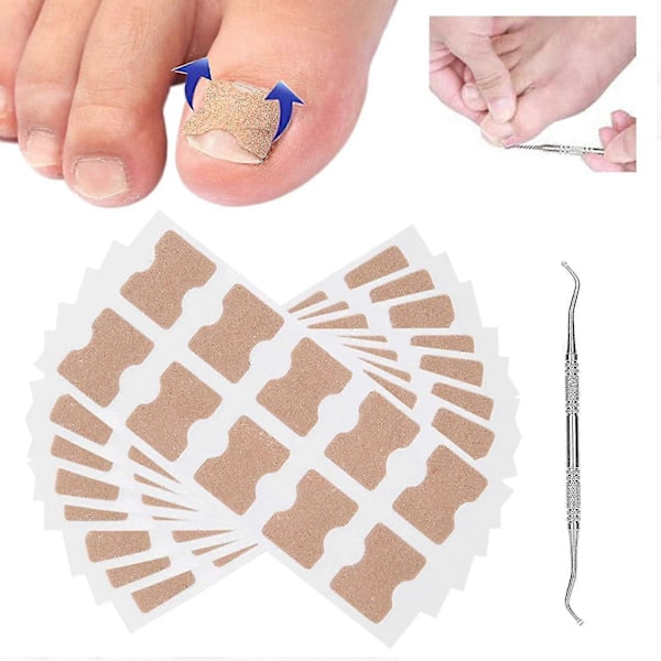 Inåtväxt Tånagel Klistermärke Med Tånagel Hyvlingsverktyg, 80st / Set Tånagel Korrigeringsplåster Tå Korrigerings Klistermärke Limfri Nagelkorrigeringsplåster Pedikyr