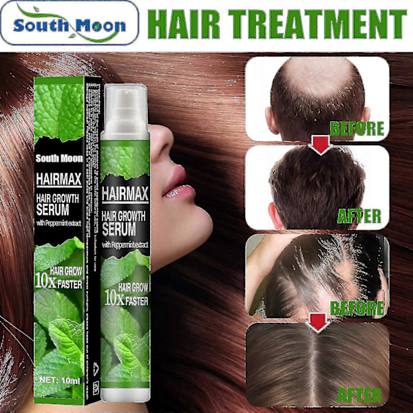 South Moon Hår Anti-hårtap Spray Hårlinje |  | 3STK-7350943006878