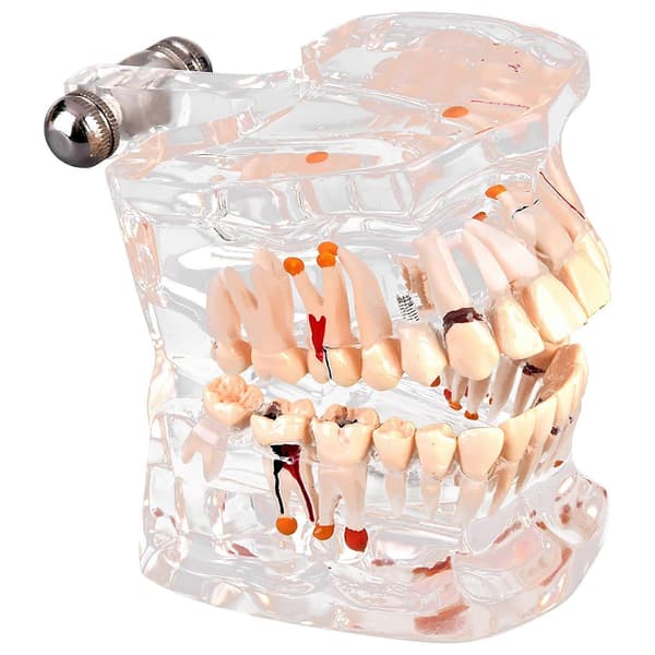 Ny Dental Undervisning Studie Standard Tandmodell Demonstration Sjukdom Utbildning