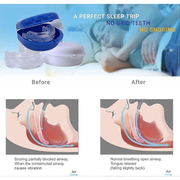 Anti Snoring Bruxism Munskydd Förbättra Sömnen Tandgnissling Sömn Anti Snarkning Och Apné Snarkanordning För Att Stoppa Snarkning