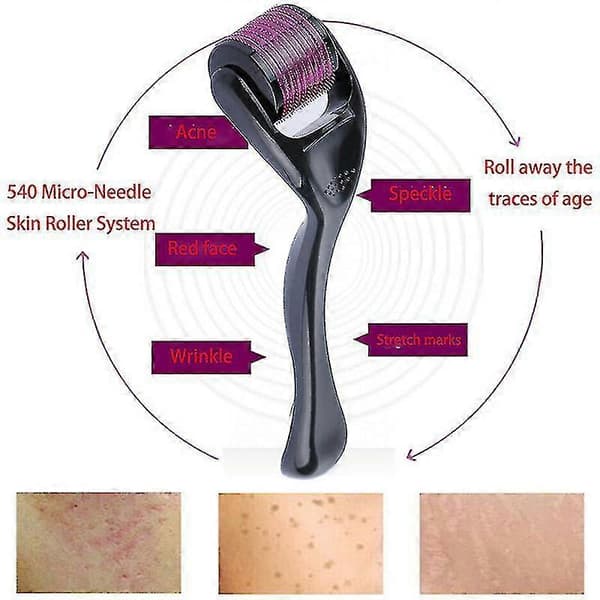 Derma Roller Titanium 540 Mikronåler Derma roller Anti-aldring 1 stk svart