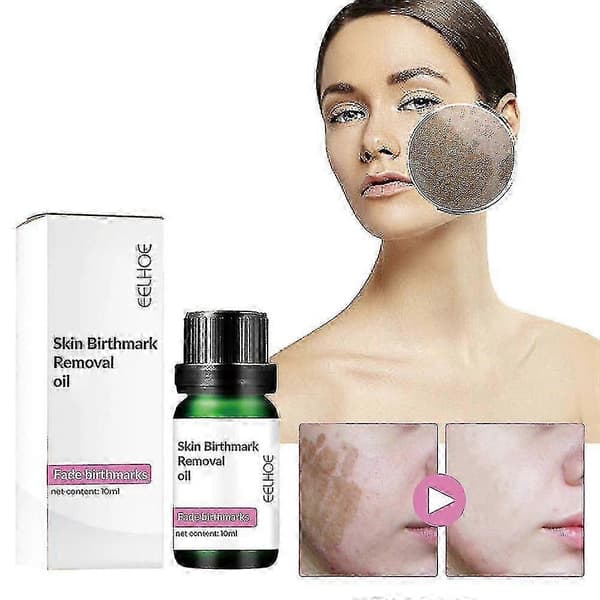 Eelhoe Luomenpoistoöljy 10ml -8383398484006