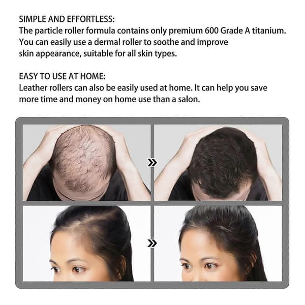 JAYSUING Hårväxt Roller Säker Smärtfri Titan Microneedle Roller Stark Rot Näring Hårbotten Läker -8390696389926