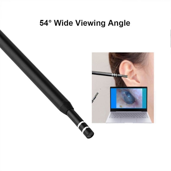Visuel Øreske HD 300 Tusind USB Ørerensningsendoskop 54 Digitalt Øreendoskop YEMMA