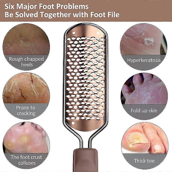 Fotfil for Pedikyr - Fjerner Hård Hud - Stor Fot Rasp - Profesjonell Rustfritt Stål Fot Skrubber for Våte og Tørre Føtter