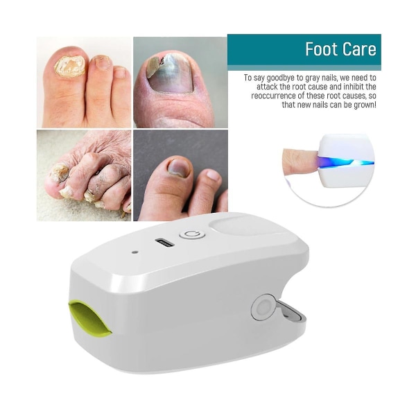 905NM Nail Therapeutic Instrument Portable Painless Nail Laser Therapy Device Anti-Slip Silicone