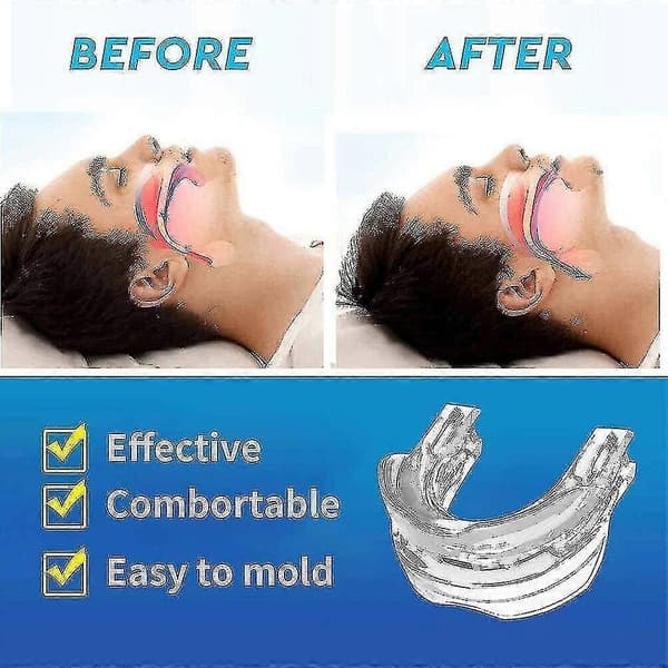 Justerbart Anti Snoring Munstycke Guard Anti Snore Sömnapné Tänder Grind