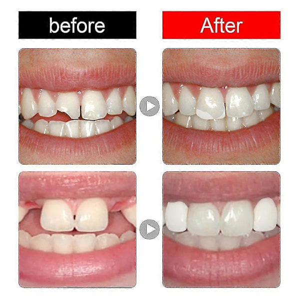 Formbar tandfyllning falska tänder temporärt reparationskit - Bazhou Solid Glue Denture