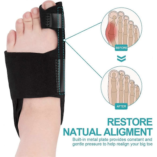 Hallux Valgus Korrigerare Perfekt för Stortå, Sneda Tår och Smärtlindring, Hallux Valgus Splint Stortå Korrigerare, 1 Par