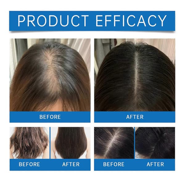 1-5X Avancerad Hårväxt Roll-On Serum Rosmarin Hårväxt Serum Roll On Förhindrar Håravfall Stimulerar Hårfolliklar 3pcs
