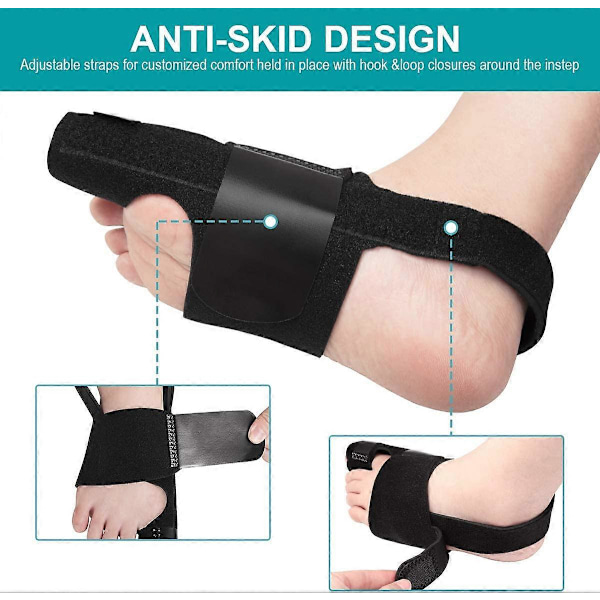 Hallux Valgus Korrigerare Perfekt för Stortå, Sneda Tår och Smärtlindring, Hallux Valgus Splint Stortå Korrigerare, 1 Par