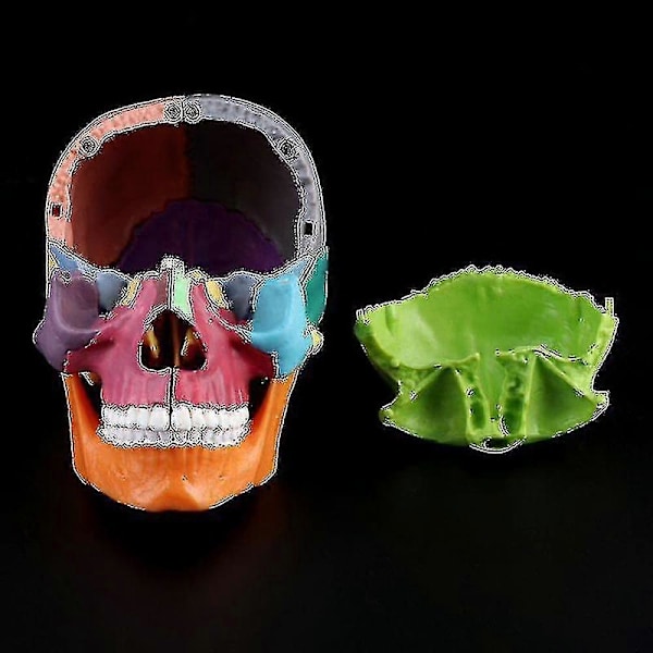 4d Demonterad Färg Skalle Anatomisk Modell Löstagbart Läroverktyg PFK