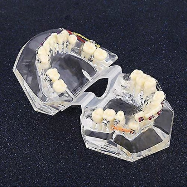 Tandmodell för utbildning, dental ortodontisk behandling, malocklusion, studiedemonstration, tandmodell med trådkedja, orange