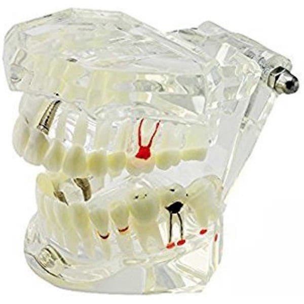 Dental Studie Undervisning Tandmodell Vuxen Typodont Modell Avtagbar Tand
