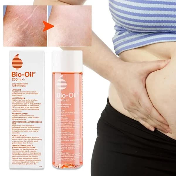 BioOil För Tillväxtlinjer & Graviditetslinjer Paro Eterisk 200ml Baro Bio Eterisk