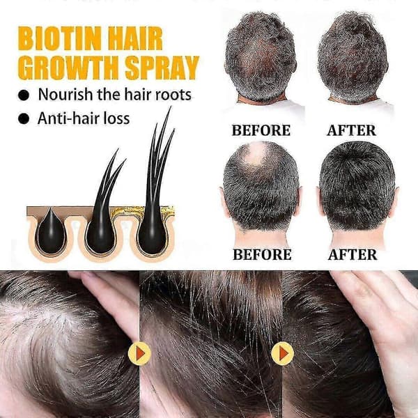 3-pack Biotin Håravväxt Spray Anti Håravfall Snabb Återväxt Hårbotten Behandling Serum