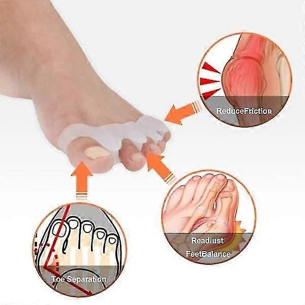2 st Hallux Valgus Tåspridare Separerar Tårna Stöd Tåskiljare