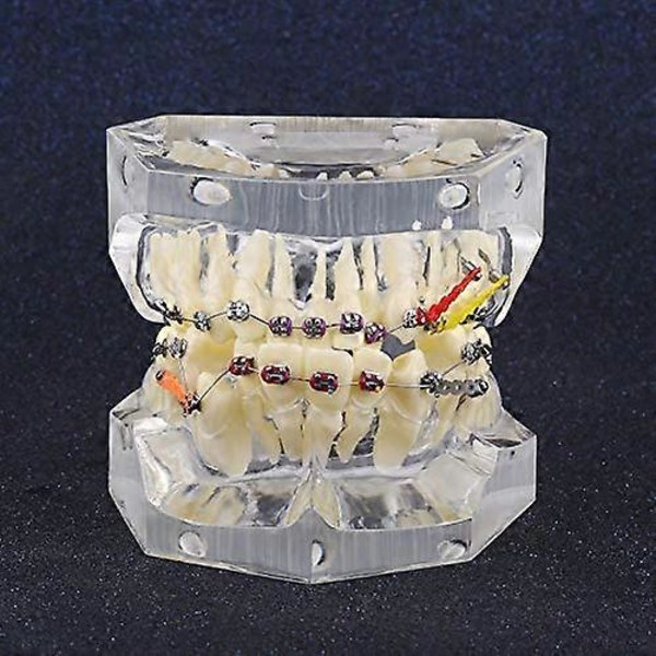 Tandmodell för utbildning, dental ortodontisk behandling, malocklusion, studiedemonstration, tandmodell med trådkedja, orange