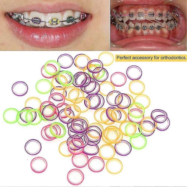 100 stk./sett Profesjonell Dental Elastisk Strikk Munn Ortodontisk Verktøy 2.5oz