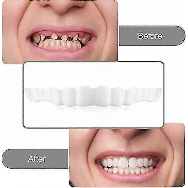 Smile Snap On Falske Tenner Øvre Nedre Tannfasetter Proteser Tann Deksel Sett PTW
