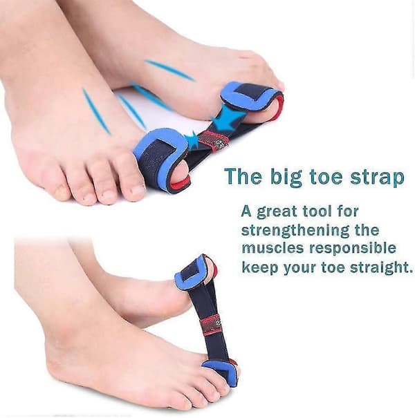 7 st Bunion Corrector & Bunion Relief Skyddshylsor Kit-ZZY