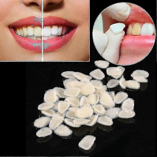 70 st./påse Tandfasader Resin Främre Övre Temporär Krona För Dental Oral Vård-FCY