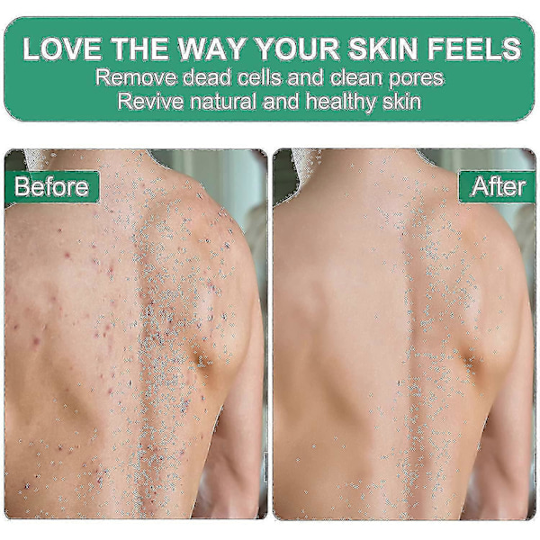 Exfolierande Handskar 2 st Spa Exfolierare Skrubb För Bad Dusch Exfolieringsvante, Kroppsskrubb Exfolierare