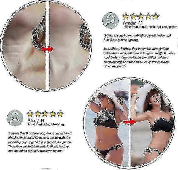 Lymfedrenasjering, 4 stk. Lymfedrenasje Terapeutisk Magnetisk Ring, Smertelindring Reduserer Tretthet