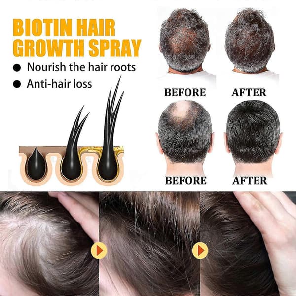 3x Biotin Anti Snabb Återväxt Hårbotten Serum