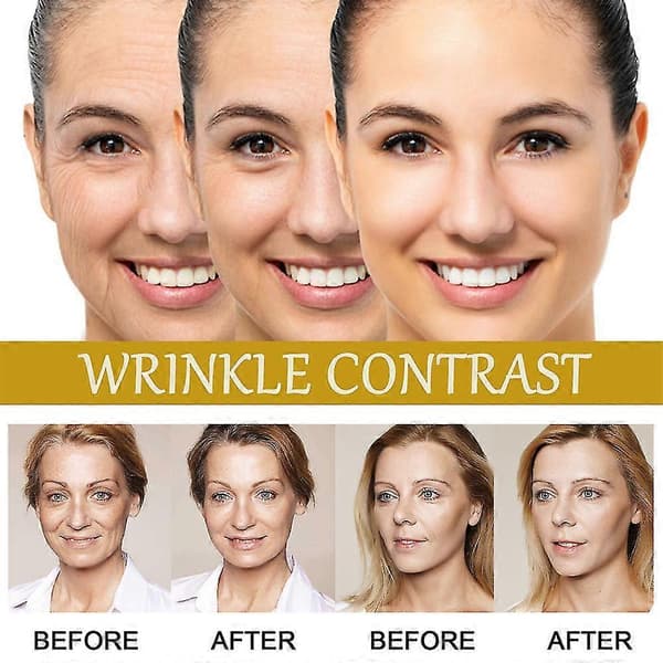 3x Avancerat Bivenomserum Anti-aging Fuktighetskräm För Ansikte Och Hals