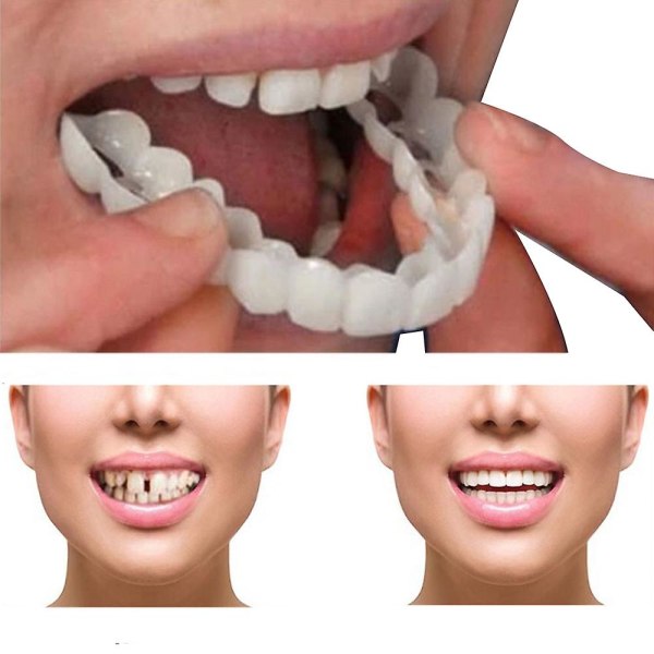 Fake Teeth Cover Teeth Braces Øvre Braces Falske Teeth Teeth Finers Cover Magic Teeth Brace