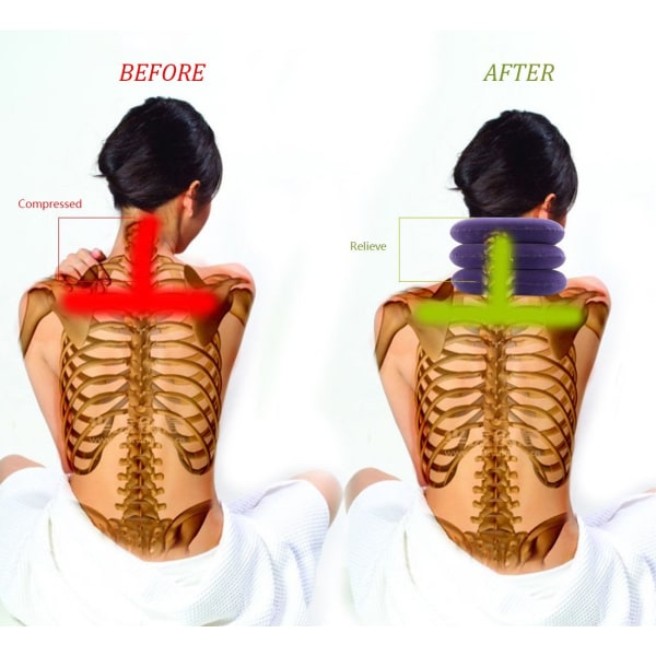 Traktionsanordning för halshals Uppblåsbar nacksträckare, lätt att använda för kronisk nacke- och axelsmärtalindring dragningsryggradsjustering (lila) Purple