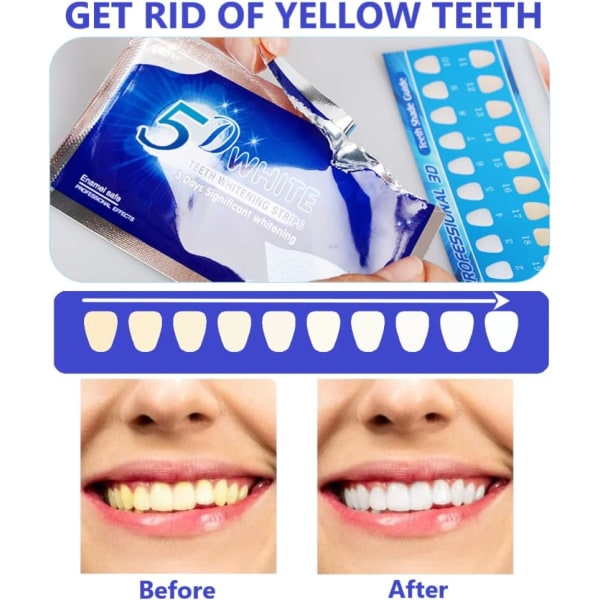 Tandblekningsremsa - 14 remsor Effektiv tandblekningsremsa minskad känslighet, professionell och säker tandblekningsremsa
