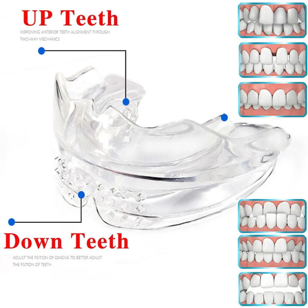 3 kpl / set Dental Tooth Orthodontic Appliance Trainer