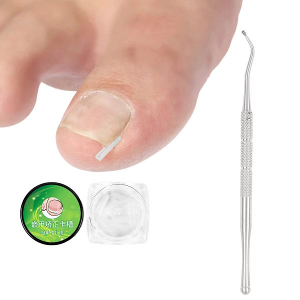 20 st Ingrown Toenail Patch Ingrown Toenail Verktyg  Kvinnor Fot Nagelvård