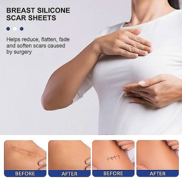 Silikon ärrlakan Silikonärrlakan för bröst 8-pack bröstförminskning efter operation för ärr, ärrborttagningsark, 4 Areola Soft Strips & 4 An