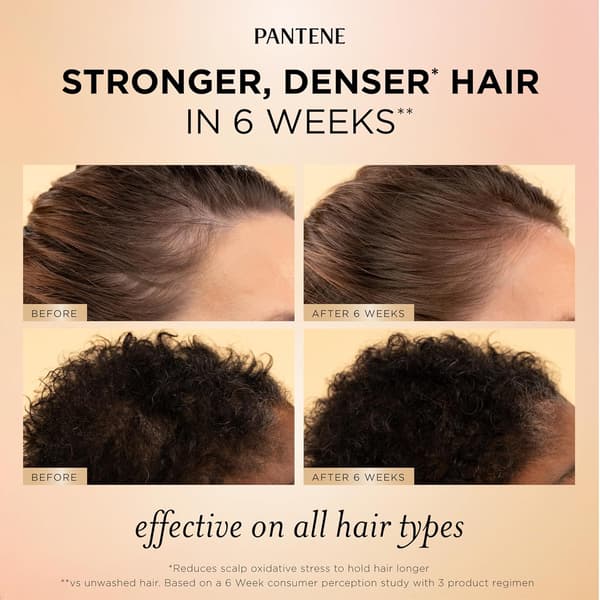 Pantene Abundant & Strong Daglig Hodebunnsserum, Styrker Hodebunnens Grep om Røttene, 59 ml
