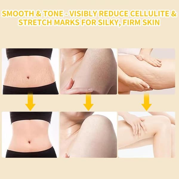 Electric Lymphatic Massager - Deep Cellulite Massage & Body Massage with Display