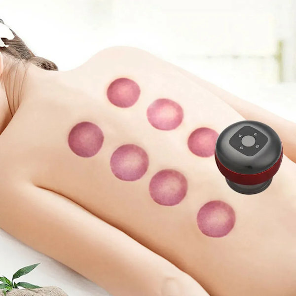 Elektrisk Kopping Apparat Kopping Terapi Guasha Kopping Massage Vibration Genopladelig Kopping Apparat Massageapparat