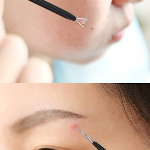 5-pack Blackhead Remover Acne Needle Tools Kit Svart Svart+grå