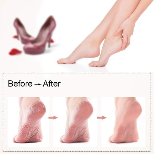 Electronic Foot File for Calluses, Rechargeable Electric Foot File P